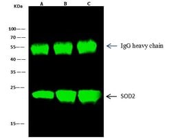 Invitrogen SOD2 Polyclonal Antibody 100 &mu;L; Unconjugated:Antibodies,
