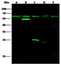 Invitrogen HAI-1 Polyclonal Antibody 100 &mu;L; Unconjugated:Antibodies,