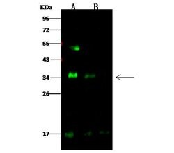 Invitrogen HAI-2 Polyclonal Antibody 100 &mu;L; Unconjugated:Anticorps,