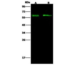 Invitrogen CD43 Polyclonal Antibody 100 &mu;L; Unconjugated:Antibodies,