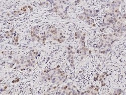 Invitrogen SUV39H2 Polyclonal Antibody 100 &mu;L; Unconjugated:Antibodies,