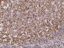 Invitrogen TACC3 Polyclonal Antibody 100 &mu;L; Unconjugated:Antibodies,