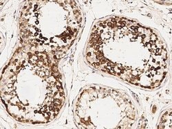 Invitrogen TACC3 Polyclonal Antibody 100 &mu;L; Unconjugated:Antibodies,