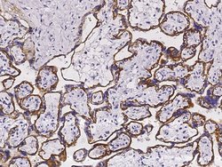 Invitrogen TROP2 Polyclonal Antibody 100 &mu;L; Unconjugated:Antibodies,