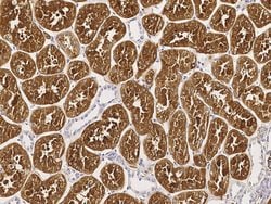 DP2 Polyclonal Antibody, Invitrogen 100 &mu;L; Unconjugated:Antibodies,