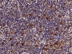 Invitrogen CD30 Polyclonal Antibody 100 &mu;L; Unconjugated:Antibodies,