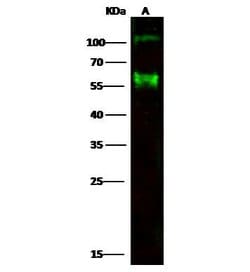 Invitrogen CD30 Polyclonal Antibody 100 &mu;L; Unconjugated:Antibodies,