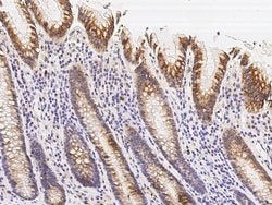 Invitrogen TRAIL Polyclonal Antibody 100 &mu;L; Unconjugated:Antibodies,