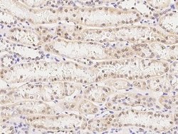 Invitrogen TRAF4 Polyclonal Antibody 100 &mu;L | Buy Online | Invitrogen&trade; | Fisher Scientific