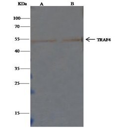 Invitrogen TRAF4 Polyclonal Antibody 100 &mu;L | Buy Online | Invitrogen&trade; | Fisher Scientific