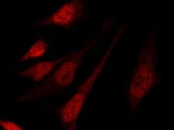 MURF1 Polyclonal Antibody:Antibodies, Polyclonal