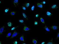 Invitrogen TSG101 Polyclonal Antibody 100 &mu;L; Unconjugated:Antibodies,
