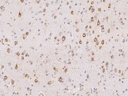 Invitrogen MPS1 Polyclonal Antibody 100 &mu;L | Buy Online | Invitrogen&trade; | Fisher Scientific