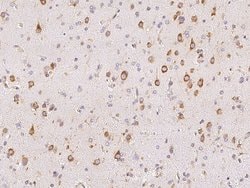Invitrogen MPS1 Polyclonal Antibody 100 &mu;L | Buy Online | Invitrogen&trade; | Fisher Scientific