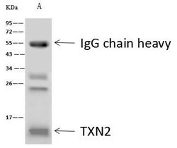 Invitrogen Thioredoxin 2 Polyclonal Antibody 100 &mu;L | Buy Online | Invitrogen&trade; | Fisher Scientific