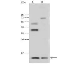 Invitrogen Thioredoxin 2 Polyclonal Antibody 100 &mu;L | Buy Online | Invitrogen&trade; | Fisher Scientific
