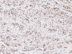 Invitrogen E6AP Polyclonal Antibody 100 &mu;L; Unconjugated:Antibodies,