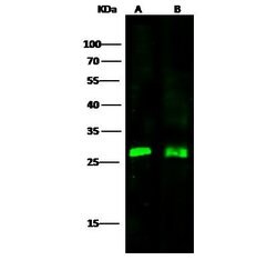 Invitrogen UCHL3 Polyclonal Antibody 100 &mu;L; Unconjugated:Antibodies,