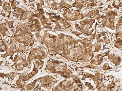 Invitrogen USP46 Polyclonal Antibody 100 &mu;L; Unconjugated:Antibodies,