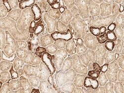 Invitrogen USP46 Polyclonal Antibody 100 &mu;L; Unconjugated:Antibodies,