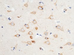 Invitrogen VAPB Polyclonal Antibody 100 &mu;L; Unconjugated:Antibodies,