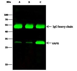 Invitrogen VAPB Polyclonal Antibody 100 &mu;L; Unconjugated:Antibodies,