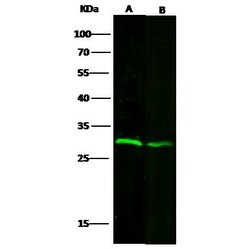Invitrogen VAPB Polyclonal Antibody 100 &mu;L; Unconjugated:Antibodies,