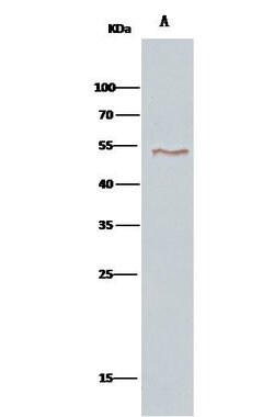 Invitrogen VRK1 Polyclonal Antibody 100 &mu;L | Buy Online | Invitrogen&trade; | Fisher Scientific
