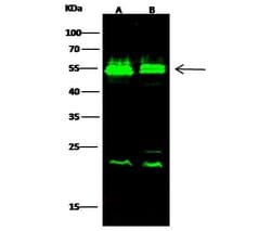 Invitrogen VRK1 Polyclonal Antibody 100 &mu;L | Buy Online | Invitrogen&trade; | Fisher Scientific