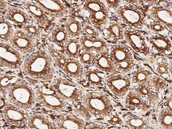 Invitrogen VSIG4 Polyclonal Antibody 100 &mu;L; Unconjugated:Antibodies,