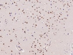 ZIC3 Polyclonal Antibody:Antibodies, Polyclonal