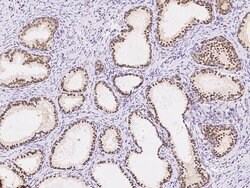 ZIC3 Polyclonal Antibody:Antibodies, Polyclonal
