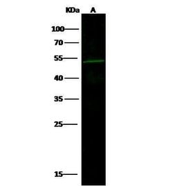 ZIC3 Polyclonal Antibody:Antibodies, Polyclonal