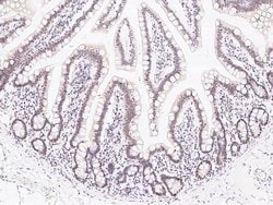 Invitrogen ZNF830 Polyclonal Antibody 100 &mu;L | Buy Online | Invitrogen&trade; | Fisher Scientific