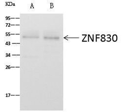 Invitrogen ZNF830 Polyclonal Antibody 100 &mu;L | Buy Online | Invitrogen&trade; | Fisher Scientific