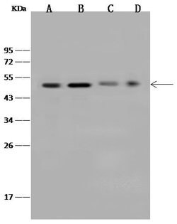 Invitrogen ZNF830 Polyclonal Antibody 100 &mu;L | Buy Online | Invitrogen&trade; | Fisher Scientific