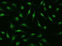 Invitrogen HSPB8 Polyclonal Antibody 100 &mu;L | Buy Online | Invitrogen&trade; | Fisher Scientific