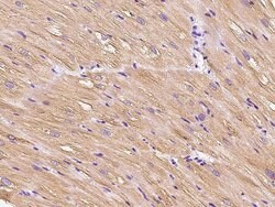 Invitrogen HSPB8 Polyclonal Antibody 100 &mu;L | Buy Online | Invitrogen&trade; | Fisher Scientific