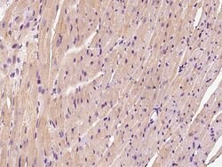 Invitrogen HSPB8 Polyclonal Antibody 100 &mu;L | Buy Online | Invitrogen&trade; | Fisher Scientific