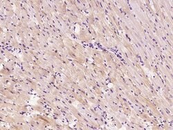 Invitrogen HSPB8 Polyclonal Antibody 100 &mu;L | Buy Online | Invitrogen&trade; | Fisher Scientific
