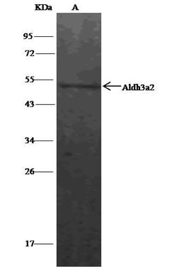 Invitrogen ALDH3A2 Polyclonal Antibody 100 &mu;L; Unconjugated:Antibodies,