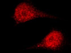 Invitrogen ASF1A Polyclonal Antibody 100 &mu;L; Unconjugated:Antibodies,