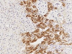 Invitrogen CaMKII alpha Polyclonal Antibody 100 &mu;L; Unconjugated:Antibodies,