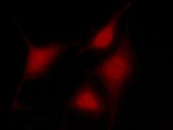 Invitrogen PRMT4 Polyclonal Antibody 100 &mu;L | Buy Online | Invitrogen&trade; | Fisher Scientific