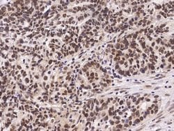 Invitrogen PRMT4 Polyclonal Antibody 100 &mu;L | Buy Online | Invitrogen&trade; | Fisher Scientific
