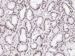 Invitrogen PRMT4 Polyclonal Antibody 100 &mu;L | Buy Online | Invitrogen&trade; | Fisher Scientific