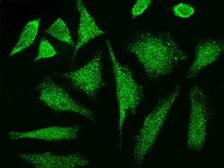 Invitrogen CCDC6 Polyclonal Antibody 100 &mu;L; Unconjugated:Antibodies,