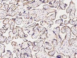 Invitrogen CCDC6 Polyclonal Antibody 100 &mu;L; Unconjugated:Antibodies,