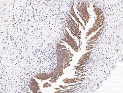 Invitrogen CCDC6 Polyclonal Antibody 100 &mu;L; Unconjugated:Antibodies,