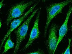Invitrogen ETS1 Polyclonal Antibody 100 &mu;L; Unconjugated:Antibodies,